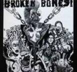 Broken Bones - Dem Bones