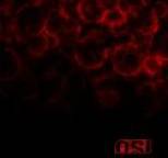 OSI - Blood